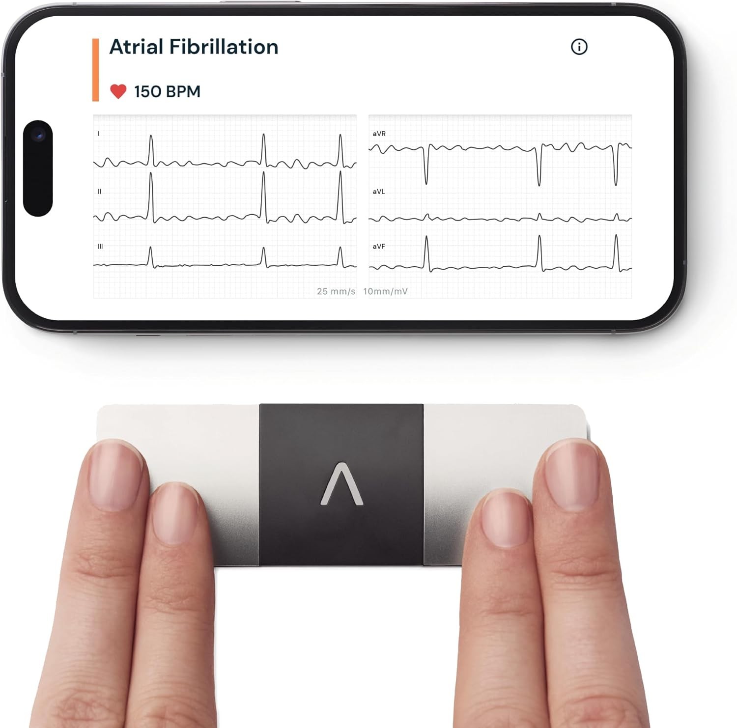 KardiaMobile 6-Lead Personal ECG Heart Rate Monitor - Detects Atrial Fibr