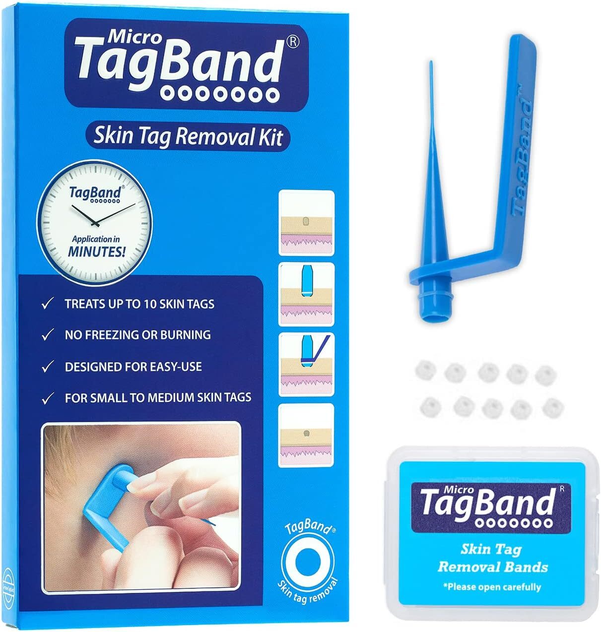 Original TagBand Skin Tag Removal Kit. Fast Effective & Safe Skin Tag Remover f